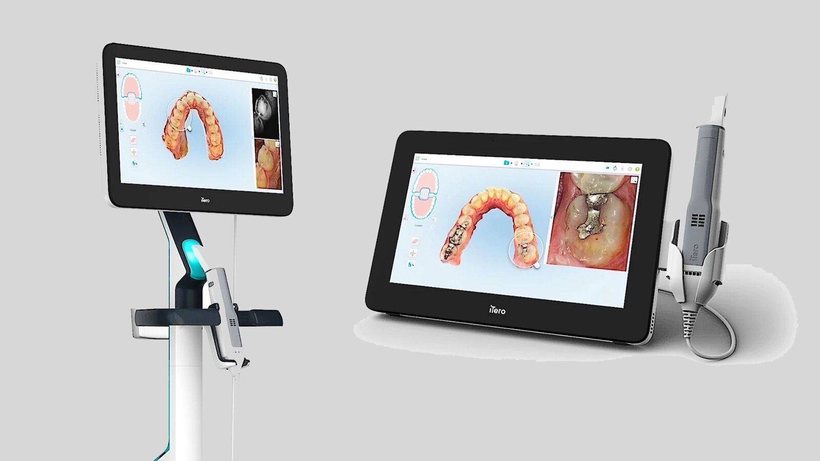 Escaneado intraoral · imagen de referencia